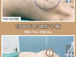 哺乳后丰胸的最佳方法：哺泉美乳霜，让你重拥丰满胸部