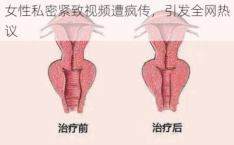 女性私密紧致视频遭疯传，引发全网热议